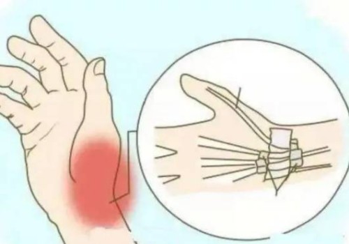 温州试管婴儿价格：试管移植后血值低别慌张，四种保胎秘籍助你渡过难关